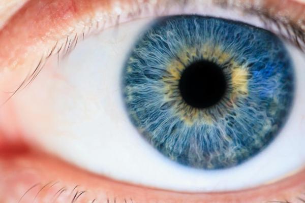 Iriscopist